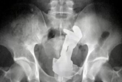 bum4.png bum4.png